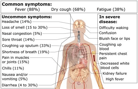 Covid-19 a Vascular & Respiratory Disease