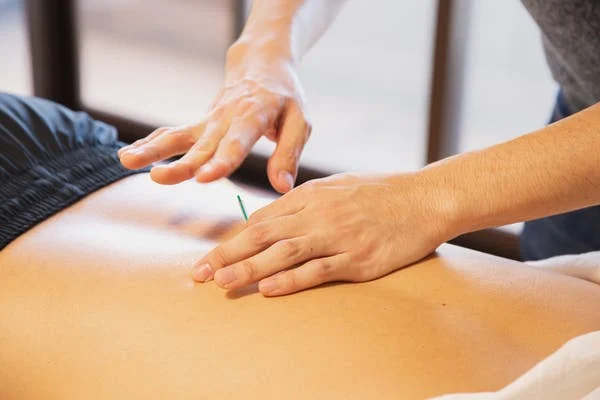 acupuncture naturopathy